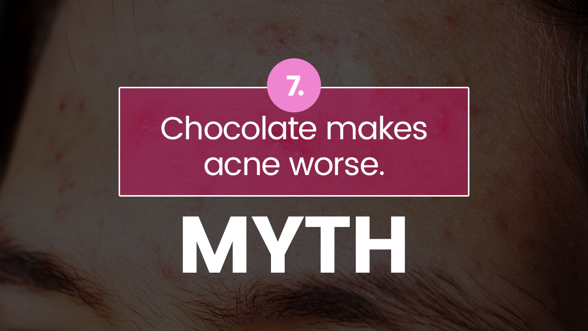 10 Acne Myths And Facts 