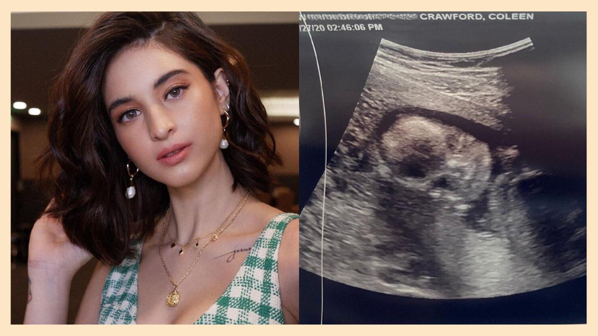 coleen-garcia-reveals-she-was-depressed-in-her-first-trimester-of-pregnancy