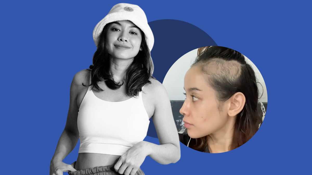 Bea Benedicto Opens Up About Extreme Hair Loss