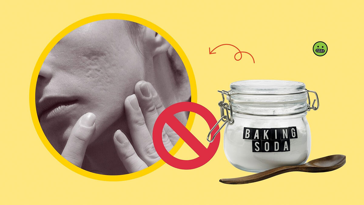 FYI: Baking Soda Can't Remove Acne Scars