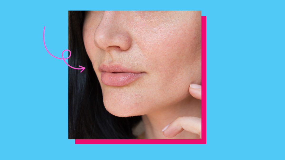 how-to-get-rid-of-clogged-pores