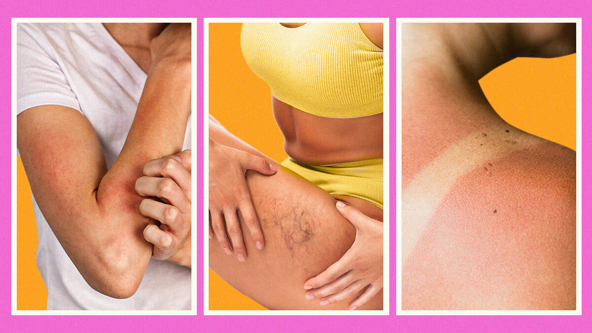 Skin Conditions: A Comprehensive Guide