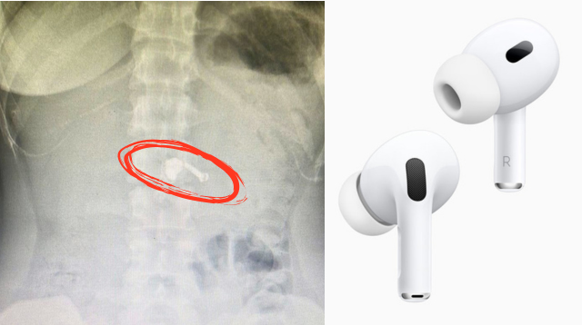 Array af Manager Ensomhed Young Woman Swallows Airpods In Sleep | Smart Parenting