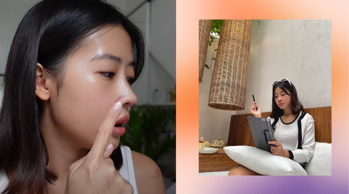 Aika Agustin Gets Real About Her Rhinoplasty Experience