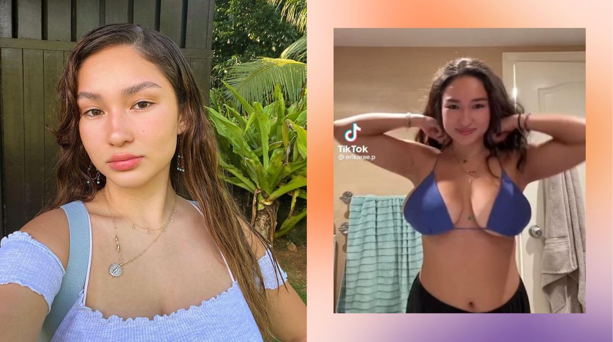 Erika Rae Poturnak Gets *Real* About Undergoing Breast Reduction Surgery