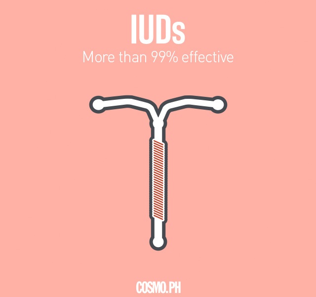 IUD birth control, contraceptive