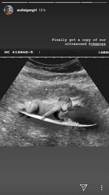 surfer baby lol