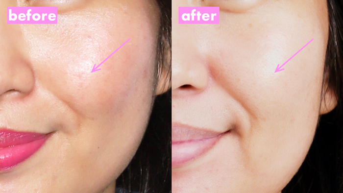 Belo Time Capsule Review, Before and After