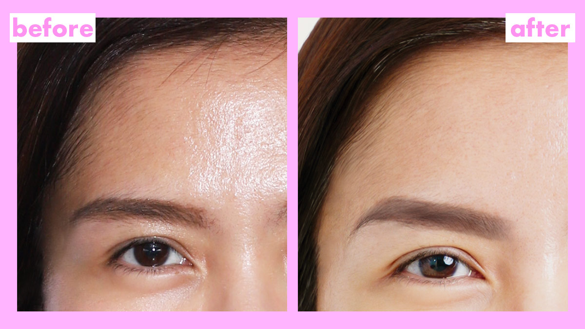 Belo Medical Time Capsule Review, Price, Before And After Photos