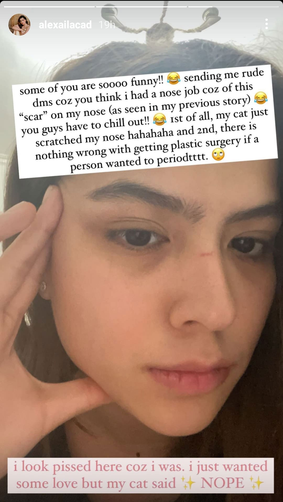Alexa Ilacad posts a reaction on her IG stories