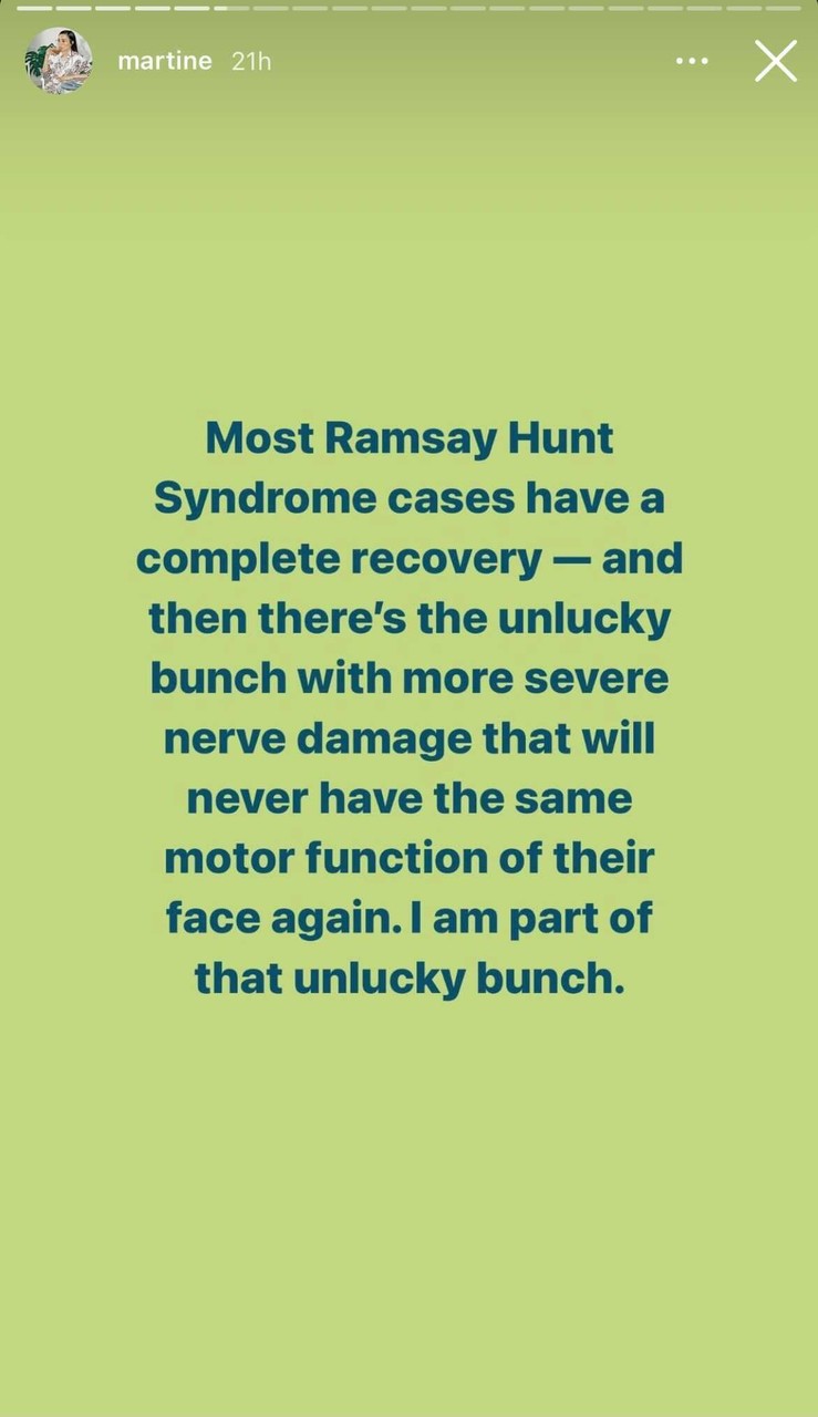 Martine Ho's Ramsay Hunt Syndrome