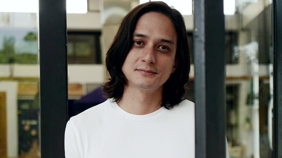 Ryan Agoncillo opens up about his past struggles with alopecia