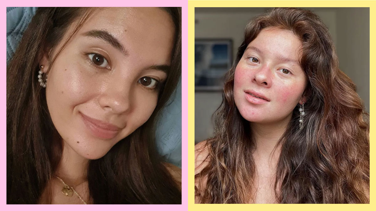 All The Times Celebs And Influencers Showed Their Real Skin Texture On IG