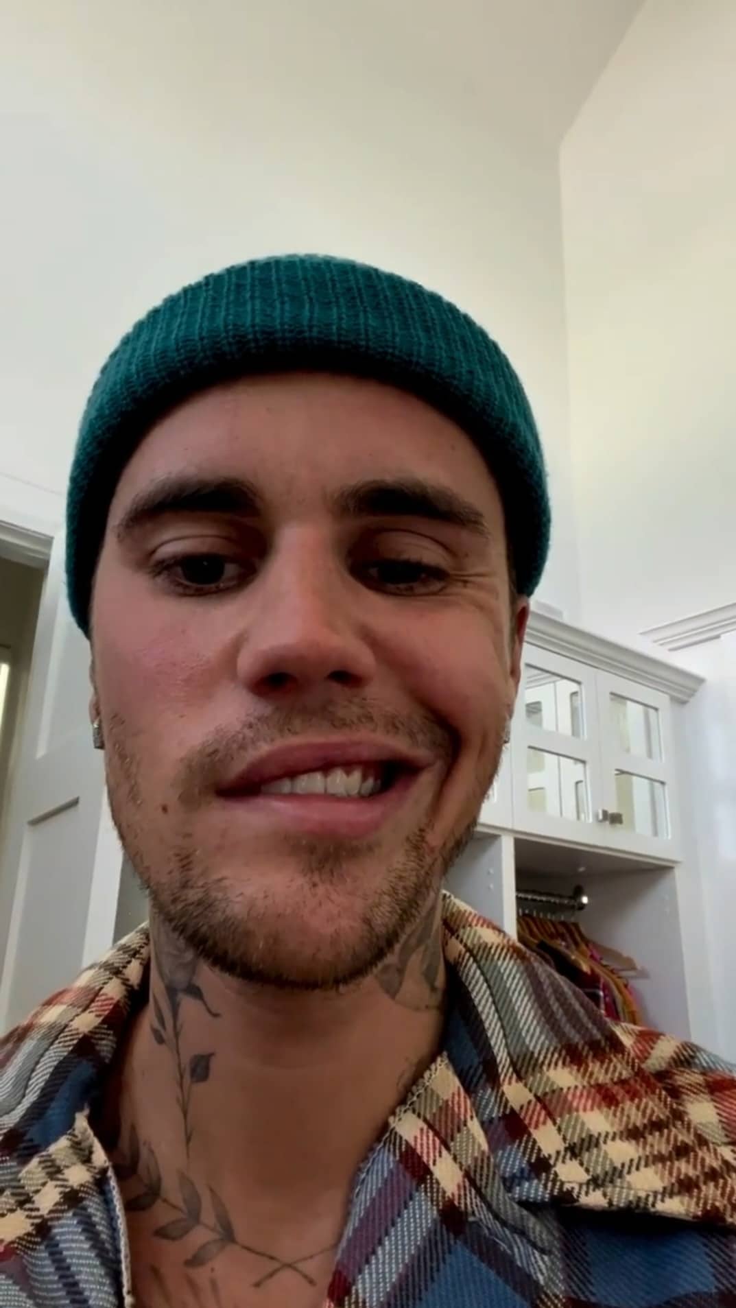 Justin Bieber suffers from facial paralysis due to Ramsay Hunt syndrome