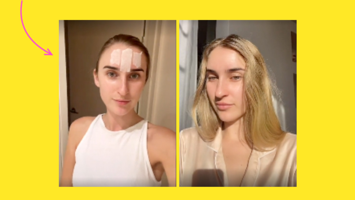 viral forehead taping trend