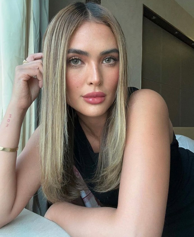 sofia andres lip fillers