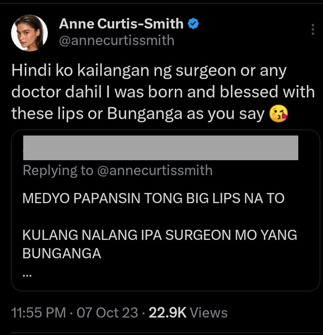 Anne Curtis responds to a netizen criticizing her bunganga