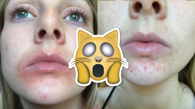 People Are Flipping Out About The Alleged Side Effects Of This Popular 