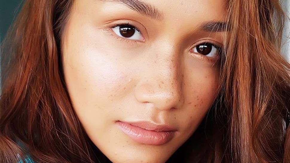 5 Ways To Avoid Breakouts During Summer