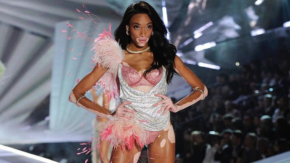 Winnie Harlow Gets Slammed for Saying ANTM Didn't Do Anything for Her Career