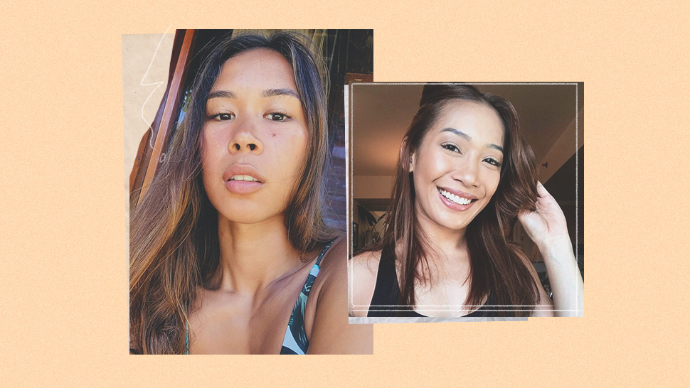 These 20-Something Pinays Tried Injectable Treatments for Fine Lines
