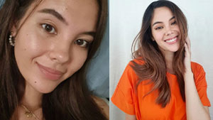 Catriona Gray Says She's Fine With Having Breakouts, Oiliness, Fine Lines, More In This No Makeup Selfie