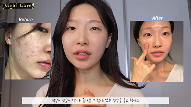 korean makeup artist glass skin routine for acne skin