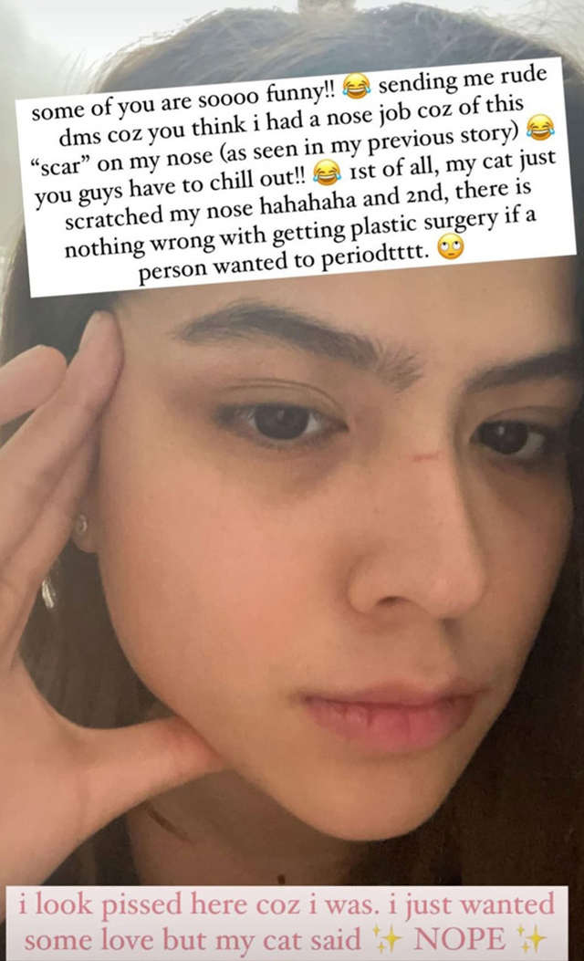 alexa ilacad plastic surgery rumors