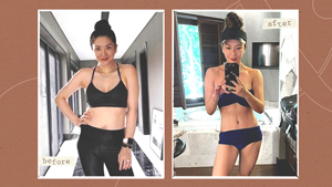 This Mom Unapologetically Turned To Plastic Surgery To Bounce Back Post-pregnancy