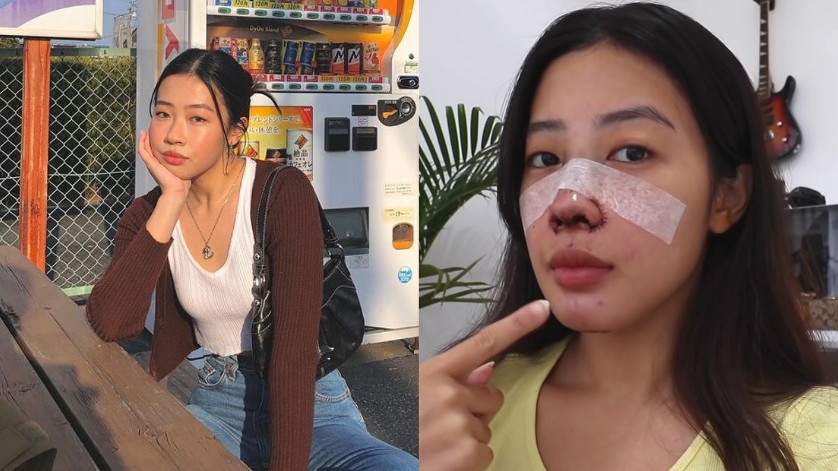 Gen Z Vlogger Aika Agustin Got Real About Her Recent Rhinoplasty Surgery