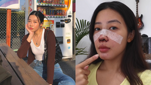 Gen Z Vlogger Aika Agustin Got Real About Her Recent Rhinoplasty Surgery