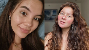 5 Celebs And Influencers Who Have Opened Up About Their Real Skin Texture
