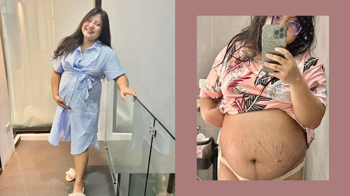 YouTuber Viy Cortez Proudly Shows Off Her Stretch Marks in An Empowering Post