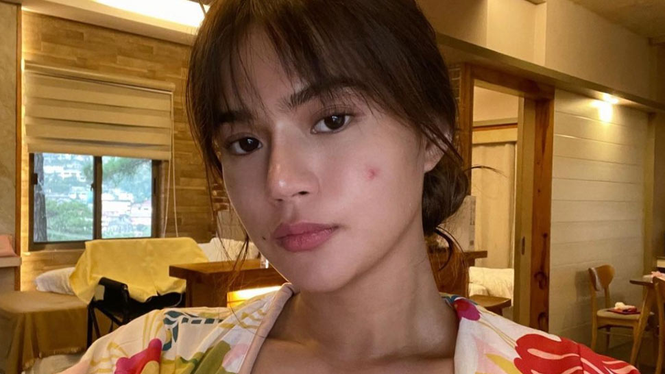 Maris Racal's Unfiltered Selfie Is Normalizing Pimples and We're All for It