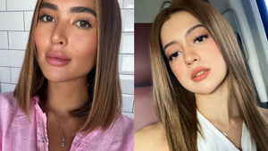6 Filipino Celebrities Who Unapologetically Admitted To Getting Fillers