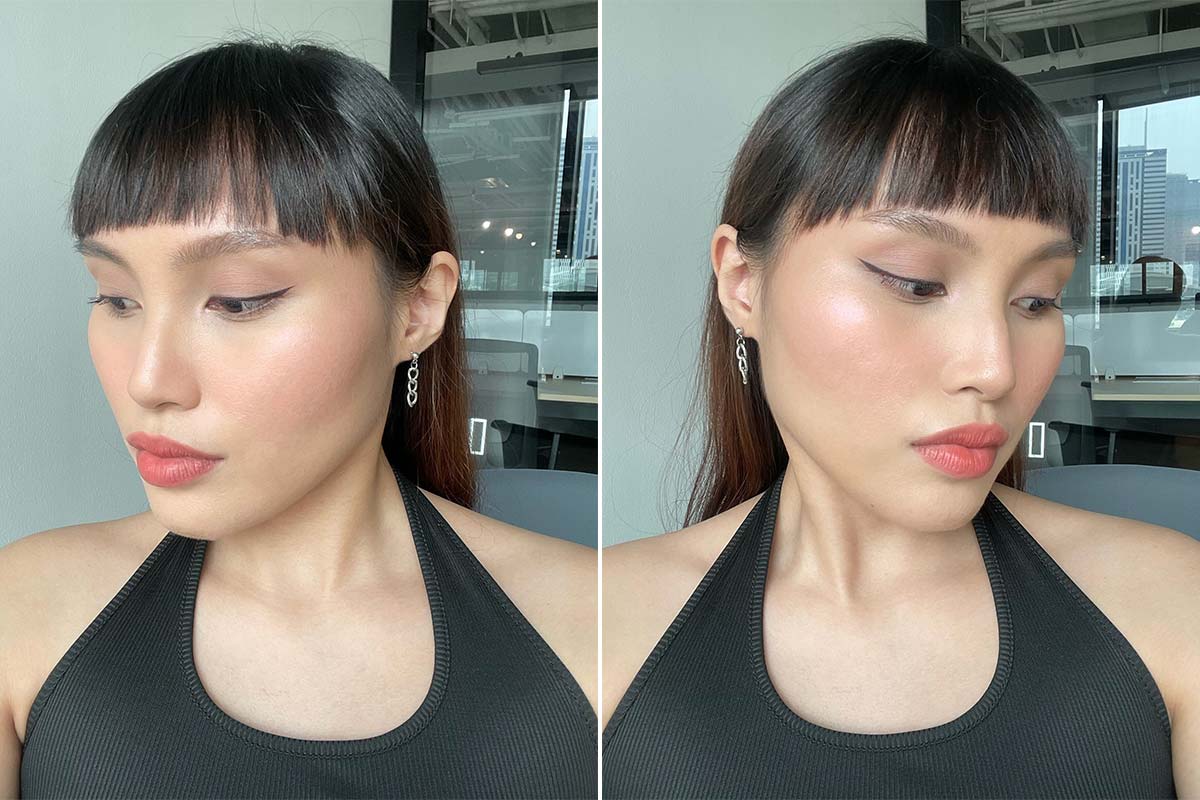 aivee sofwave before and after review