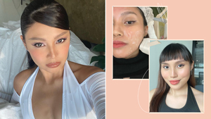 I Tried This Face Treatment To Achieve Nadine Lustre's Contoured Cheekbones