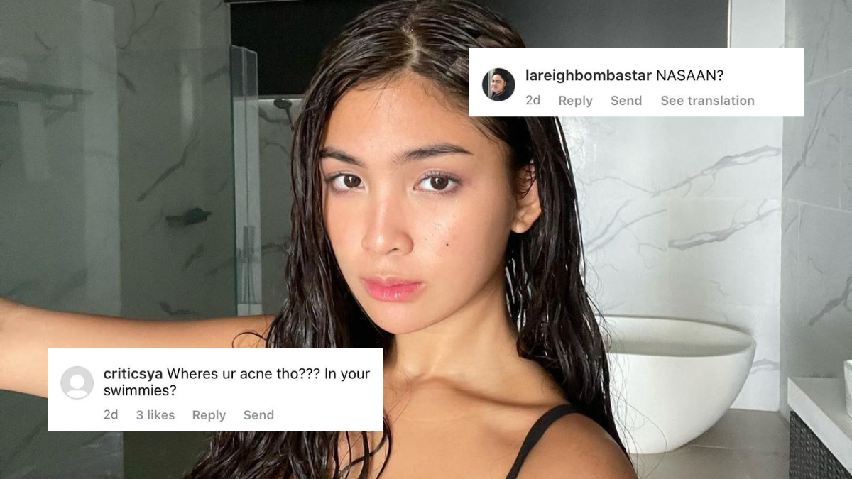 Netizens Are Calling Out Heaven Peralejo For Her Post That Claims To Normalize "acne"