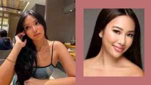 6 Filipinas Open Up About Getting Dermal Fillers