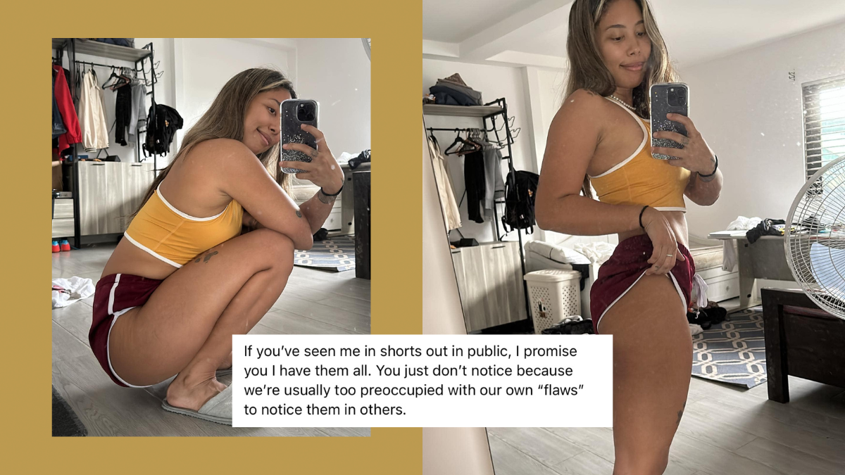 Inka Magnaye Flaunts Her Stretch Marks and Cellulite in an Empowering Post