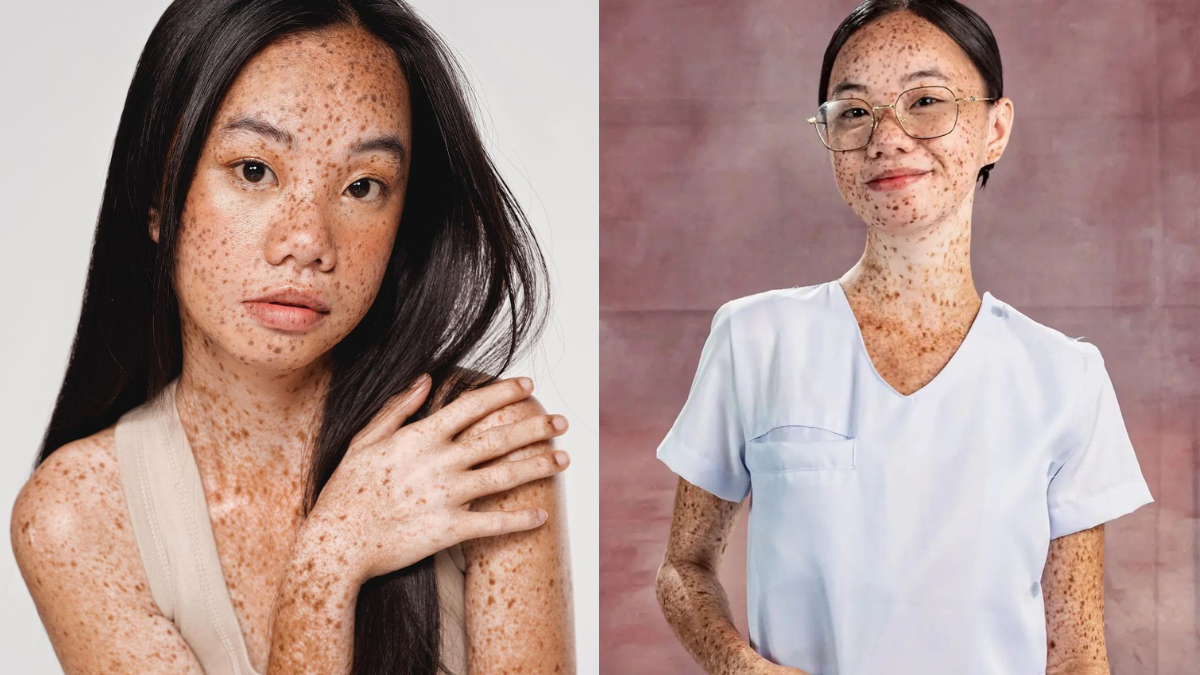 Meet Romarie Fonseca, the "Freckled Girl" Who's Making Her Mark in the Local Modeling Industry