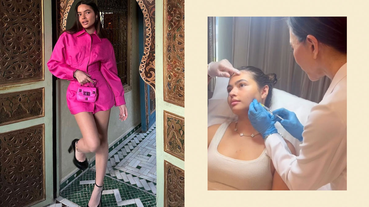 Here's Why Rocio Zobel Decided To Get Botox At 21 Years Old