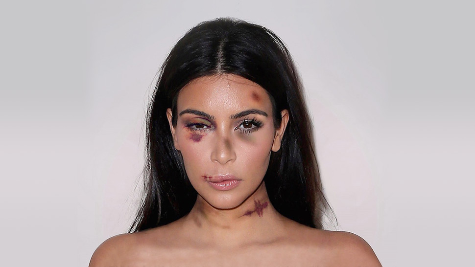 A Bruised and Battered Kim Kardashian Appears in a Viral Campaign