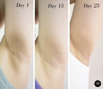 This Mom Shows You How To Beat Dark Underarms
