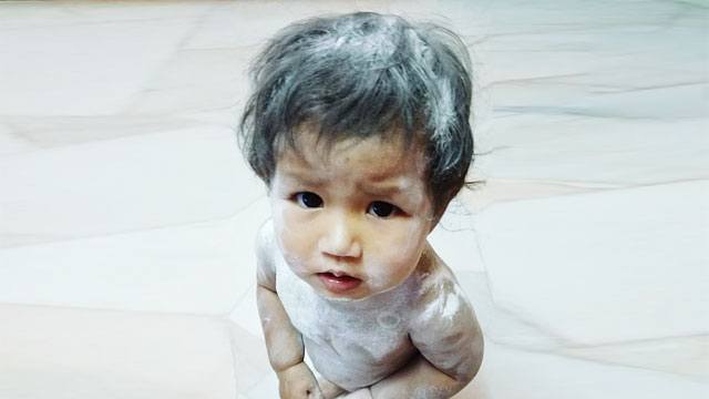Is Baby Powder Really Safe for Babies?