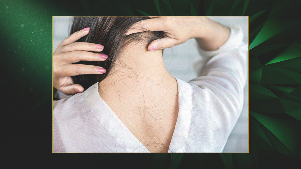 5 Reasons Your Hair Is Falling Out What You Can Do About It Preview Ph