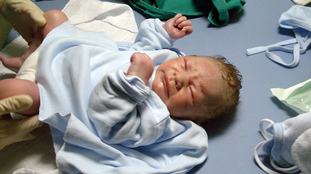 Planned C-Sections Pose More Health Risks than Emergency C-Sections, Says Study