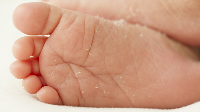 What You Need to Know About Your Newborn's Dry Skin
