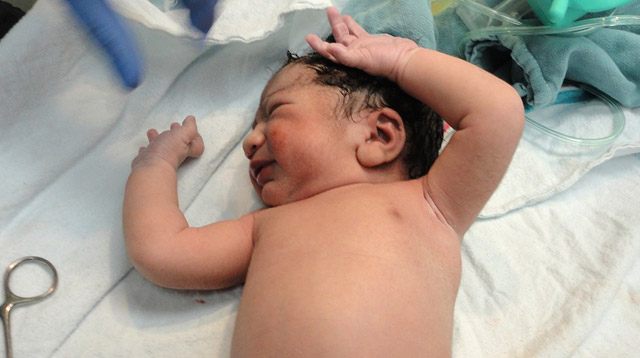 Danish Doctors Are Against Circumcision in Newborns and Kids