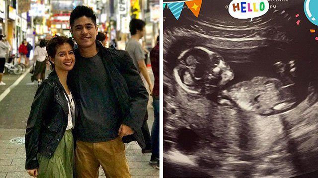 Kaye Abad and Paul Jake Castillo Have a Baby On The Way!